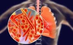 塑料收纳箱装衣服好吗 塑料收纳箱有甲醛吗?